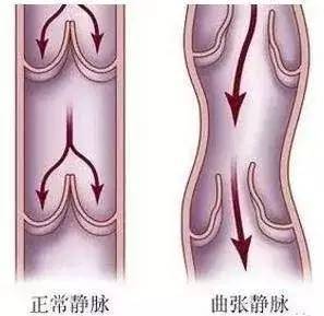 筋脉|拉开身上“筋结”，体内百病去，8至80岁都适用，简单有效