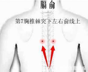 汗证|汗从哪里出，病从哪里来！夏天爱出汗的，快对照看看吧！