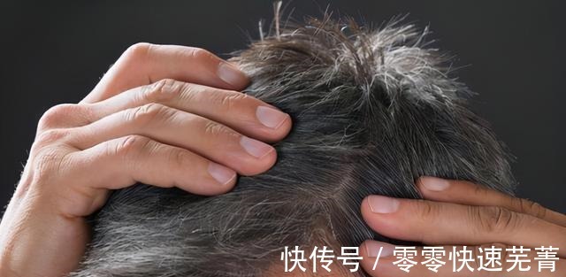衰老|为啥白发越长越多医生并非衰老这么简单,或是缺乏3种营养素