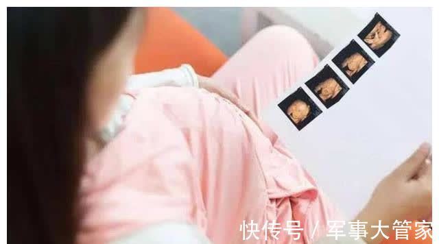 图虫|羊膜穿刺会增加流产风险,所以孕妈妈能不做就别做?真的假的?