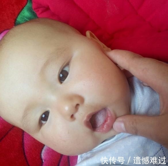 嘴角|宝宝的嘴角烂了是什么原因?又该怎么办?