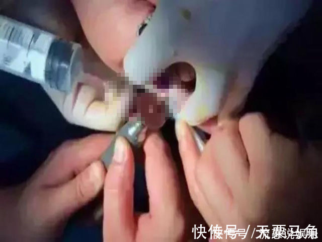顺产|孕妇顺产7小时,自己却永远成了残疾人,分娩时这玩意要摘下来