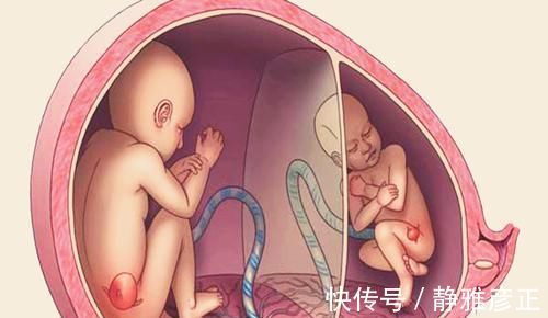 小郭|为啥女明星怀双胞胎很容易?两种惯用方式,一般妈妈很难接受