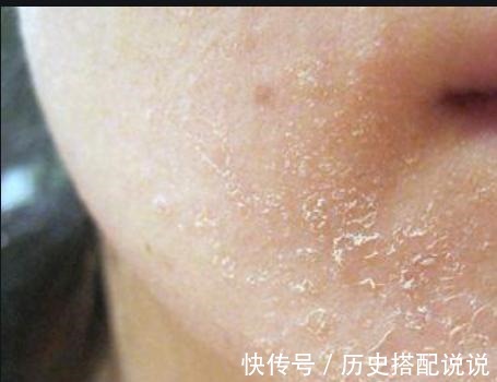 真皮层 如何选择护肤品(第三步)干皮保湿!