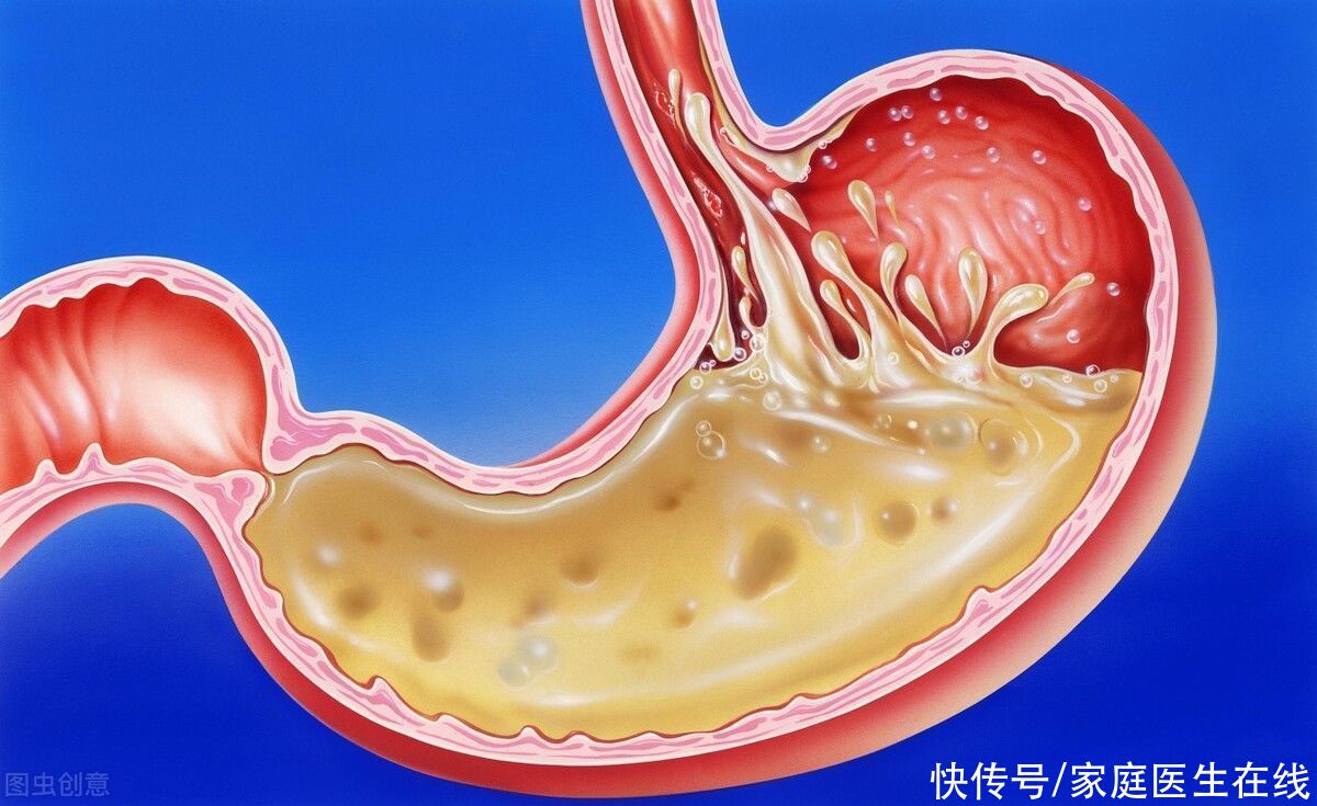 王文一|苏打水是“神水”？中和胃酸还能降尿酸？医生告诉你真相