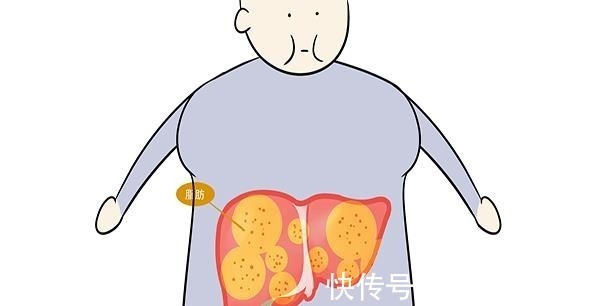 胀痛感|肝脏开始硬化时,身体会有哪些表现若都没有,放心你没得肝硬化