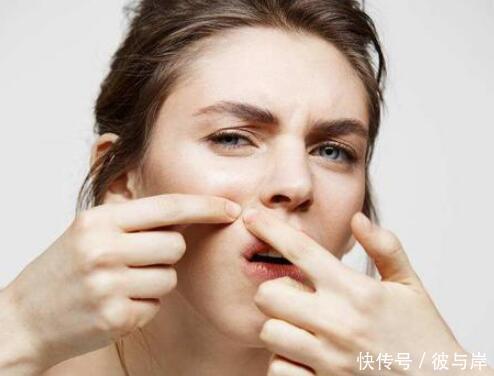 维生素c|怎么预防痘印?教你5个防痘印妙招,简单实用,不走弯路