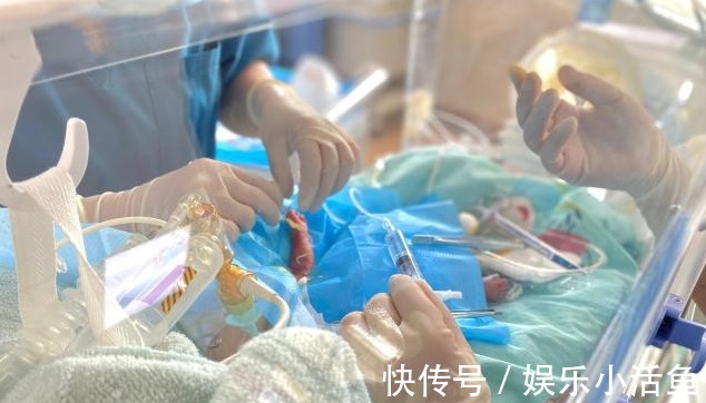 宝宝|850克!超低体重早产!历时106天守护,大理这名迷你宝宝出院啦