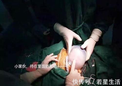 元气满满|“对不起，抓错胎了，我们重来”，产房医生的幽默，让产妇忘了疼