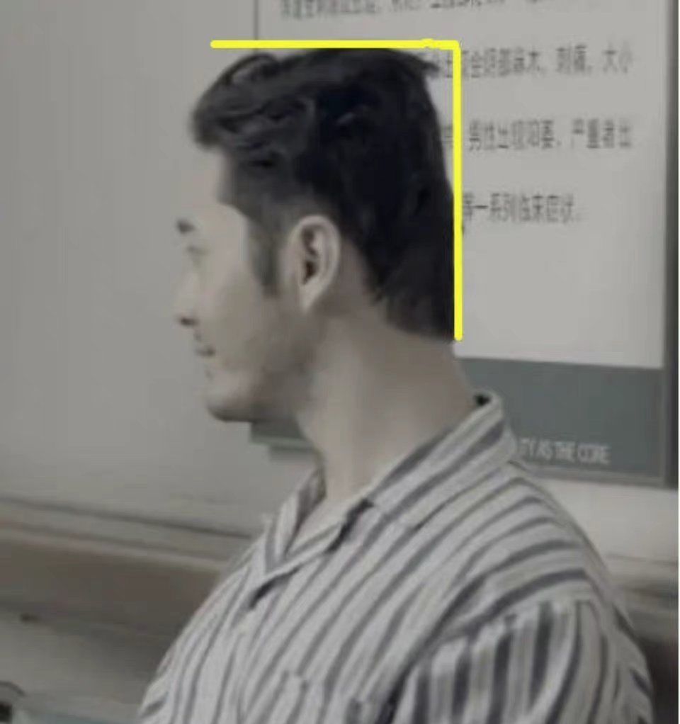 教育家|孩子扁头是福相？给孩子睡扁头真的科学吗？