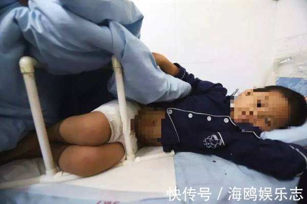 命根|15岁男孩命根疼痛难忍,父母心大不当回事,送医生检查切了吧