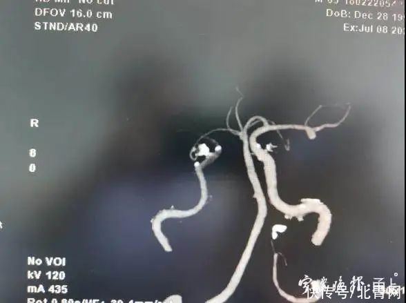 吴大伯|紧急提醒！宁波有医院一连收治16例！医生：最近这件事千万别忘了做……