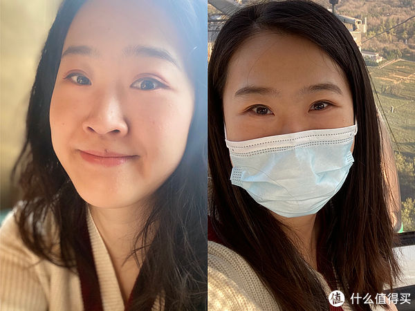 13年前做的双眼皮到现在还好吗？双眼皮带给我的变化