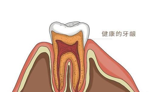 为什么半夜醒来，总是感觉到口干口苦？是身体出现问题了吗？