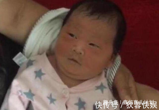 育儿|孩子出生后发现“没眼睛”,爸妈着急送医,医生看后忍不住想笑