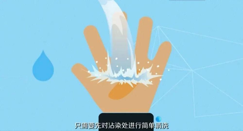 孩子|孩子被502胶水黏住了手怎么办？别慌，教你轻松搞定！