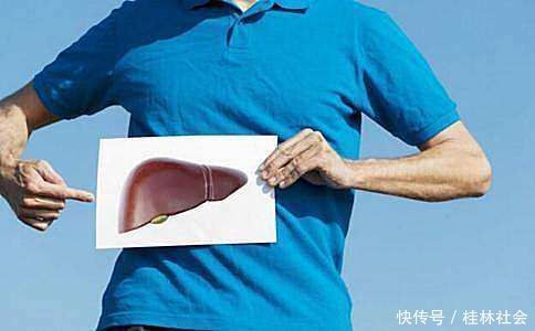 肝功能|男性“晨起”3个伤肝举动，建议要改掉，不少人还每天都在做