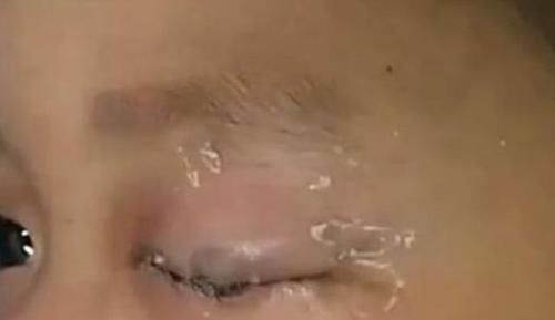 孩子|8岁儿子误把502胶水滴进眼睛里,聪明宝爸的这一举动,让医生叫好