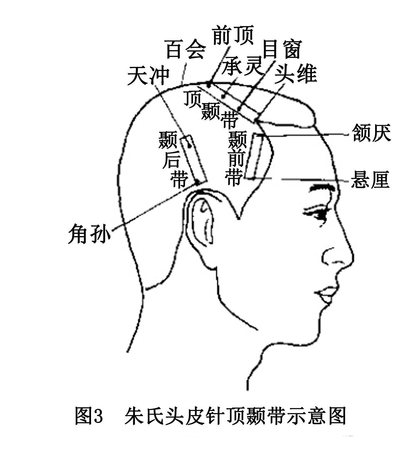 脱发区靠|按摩有助生发？