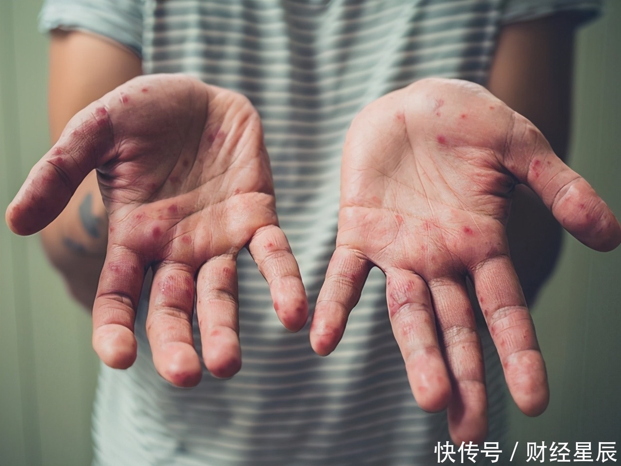 忌口|我国乙肝7000万,不想乙肝来犯,三种食物,再喜欢也要忌口