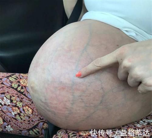 母爱|生完三胞胎后肚子却收不回去,国外宝妈的晒照,诠释伟大母爱