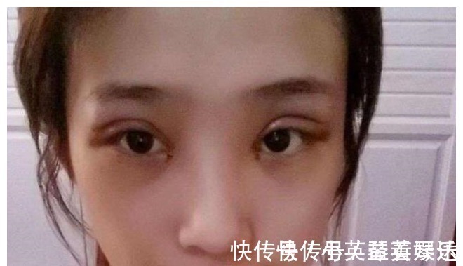 我们来了|割了双眼皮的人,老了之后会变成什么样子?可能很多人不知道吧?