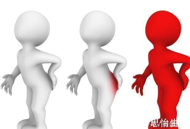 痔疮|屁股出现3大症状,痔疮需要治疗了!试试6招,帮你解决痔疮问题