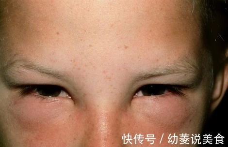 郭姐|老人脚肿腿肿,医生教他一招,不用吃药,4天后浮肿完全消失