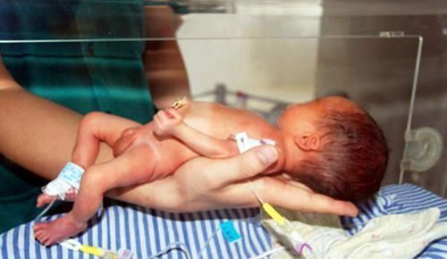 顺产有多“考验”妈妈90后产妇直言没得商量,我不要顺产