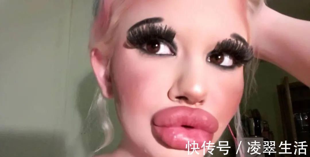 sofia 21次丰唇手术之后，这个妹子的嘴唇现在长这样…