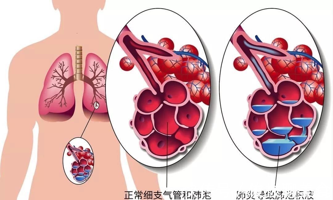 海拔|为什么说高反是纸老虎？ 中国自驾地理