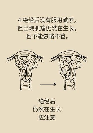 切除|得了子宫肌瘤就一定要切除？看看医生怎么说