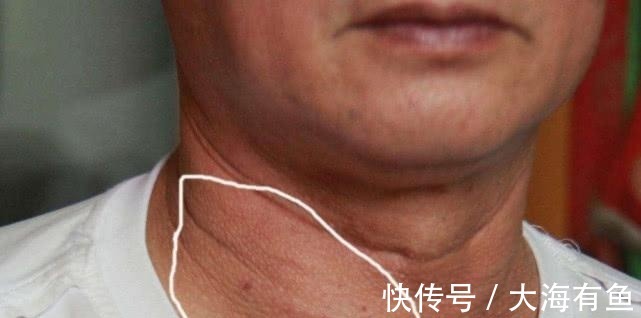 身上到处痒是艾滋病