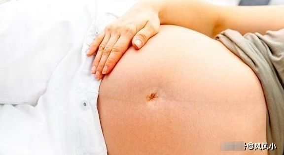 肚脐|同是怀孕，为何有的孕妇肚脐鼓出来，有的却凹进去呢？