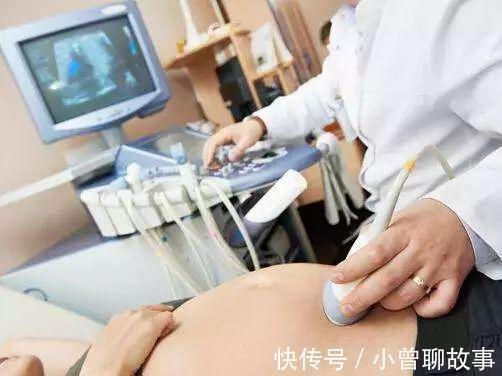 妻子|妻子怀双胞胎7个月时发现不对劲 生产时丈夫惊呆