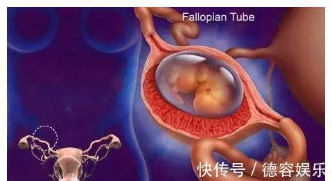 胎盘|如果孕期发现这5种异常出血情况,立刻去医院!