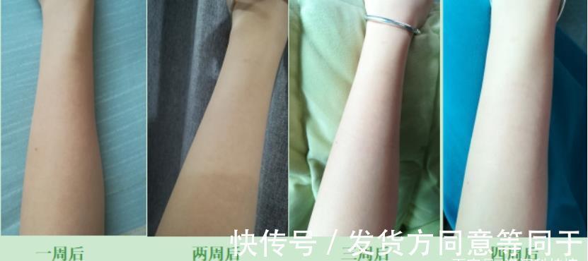 拆君|评测 ｜ 历时30天，真人实测娜蜜丝冰钻6.5高能量光子脱毛仪