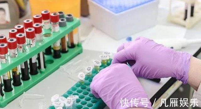 中国营养协会|四项孕检已被“叫停”,查了没啥用还不准确,专“坑”头胎孕妈