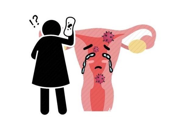 紧张性|时不时的偏头疼,究竟什么原因?医生告知4个因素你可能想不到