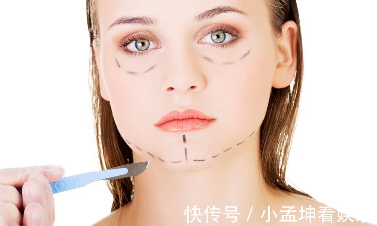 大卫·米勒德|为什么劝女人不要割“双眼皮”?主要有这5个原因,庆幸没跟风