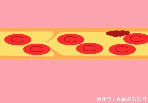 3种调味剂,比糖和盐更“伤身”你或许经常吃,怪不得血管会堵