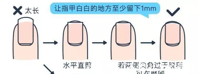 剪指甲|给婴幼儿剪指甲可不简单, 我的孩子被剪成了甲沟炎!