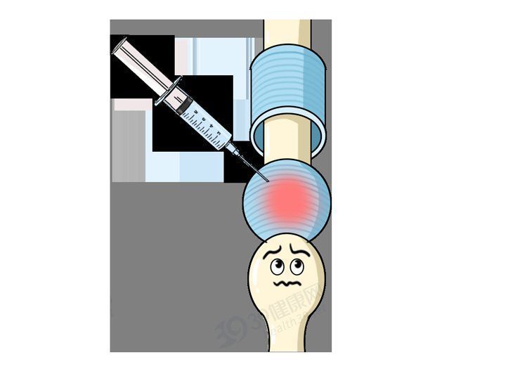 折磨|常年折磨女性的腱鞘炎，是怎么产生的？如何治疗？告诉你详细方法