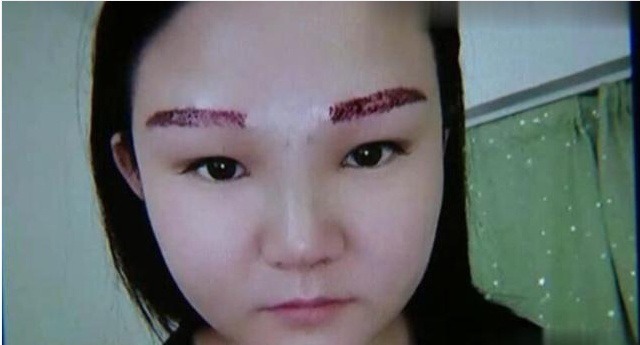 女子 女子花2万元整容,结果脸部肿成猪头,医院:这属于正常情况