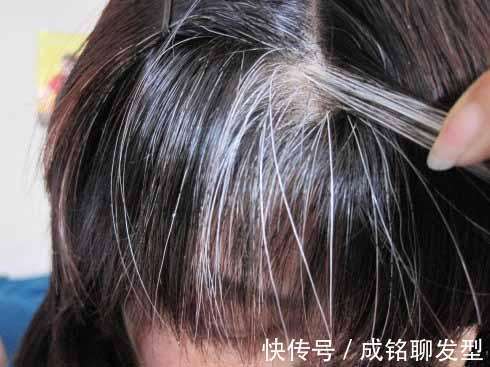 色素|年过四十的女人白发再多也别染黑,土气又老气,三个妙招告别烦恼