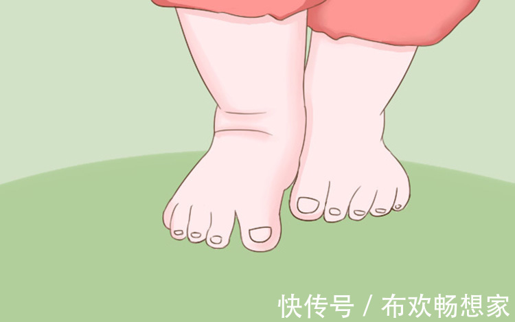 走路姿势|宝宝的这几种异常走路姿势可能影响健康,快看你家宝宝有没