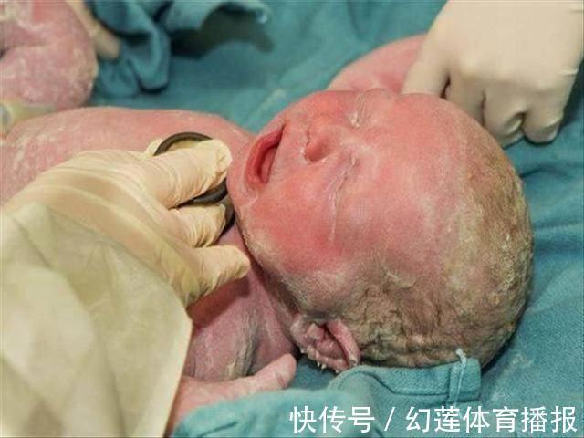 父母|婴儿刚出生后护士为什么要报几斤几两?医生不说,但是父母要知道