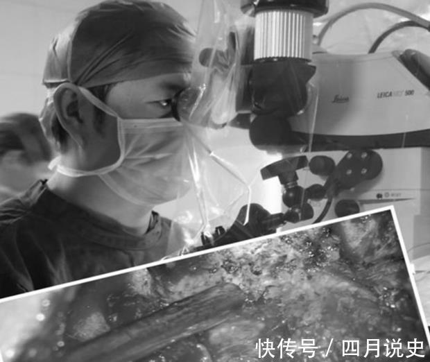 mri|下肢无力,肌肉跳动,走路像踩棉花?可能是颈椎脊髓压迫症