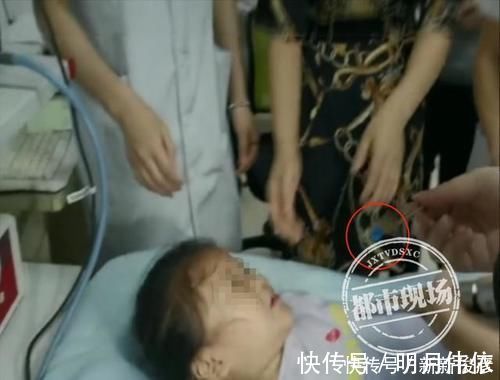 异物|4岁女童鼻里塞珠子,妈妈竟自己掏,险些要了孩子的命