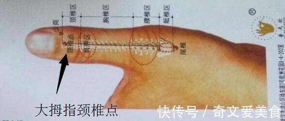 关节|花了6万也没治好的颈椎病,被这个小方法治愈了,再也没有复发